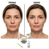 risultati prima e dopo l'utilizzo del trattamento anti rughe con bava di lumaca